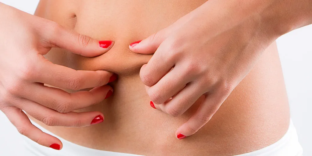 Abdominoplastia Abdominoplastia